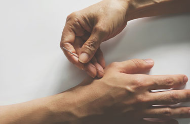 Physiotherapist using dry needling technique on patient's forearm