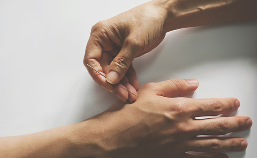 Common conditions treated by Acupuncture and Dry Needling